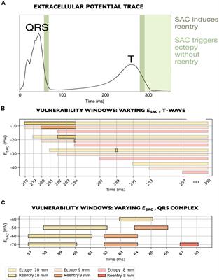 Stretch of the papillary insertion triggers reentrant arrhythmia: an in silico patient study